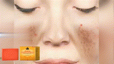 Kojic Acid Skin Lightening  Soap (HAN)