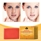 Kojic Acid Skin Lightening  Soap (HAN)
