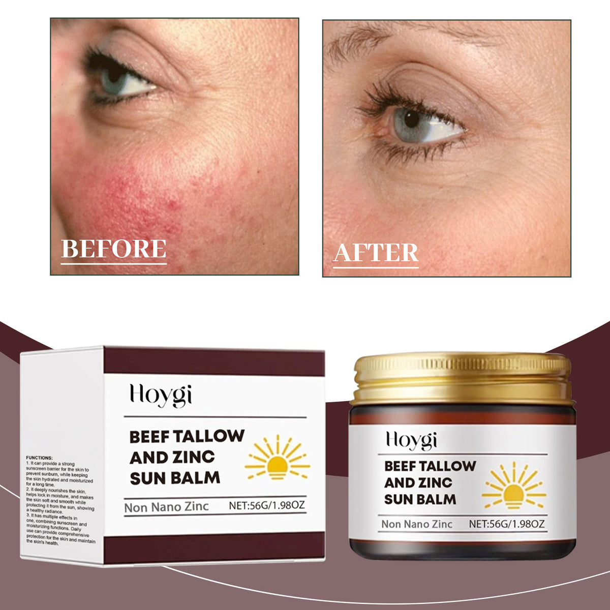 Beef Tallow And Zinc Sun Balm