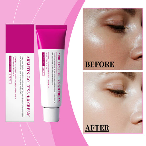 Arbutin TXA Cream