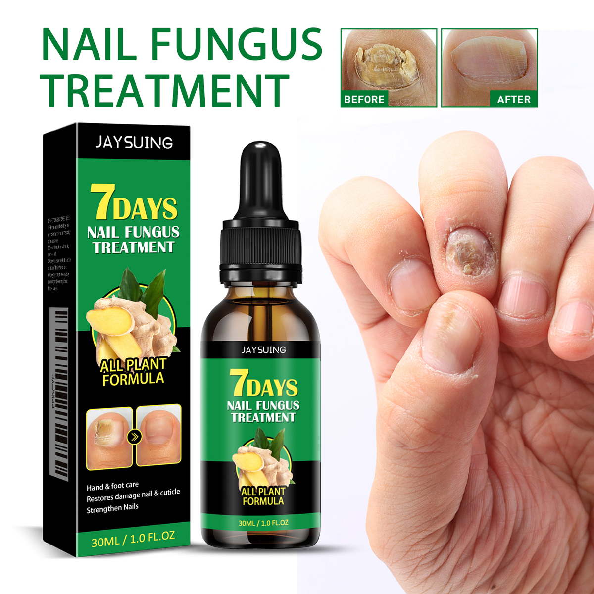7 Days Nail Fungus Treatment