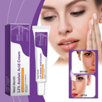 Azelaic Acid Cream