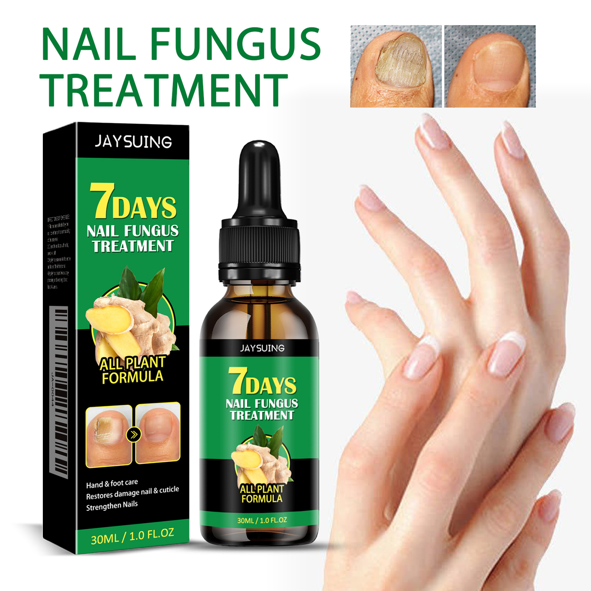 7 Days Nail Fungus Treatment