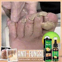 7 Days Nail Fungus Treatment