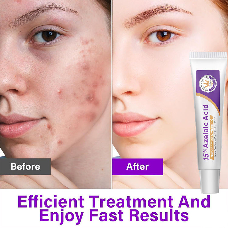 12% Azelaic Acid & 15% Azelaic Acid