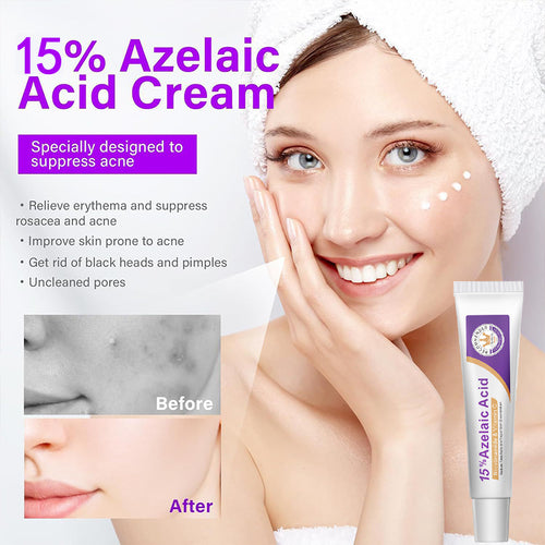 12% Azelaic Acid & 15% Azelaic Acid
