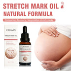 Stretch Mark Oil
