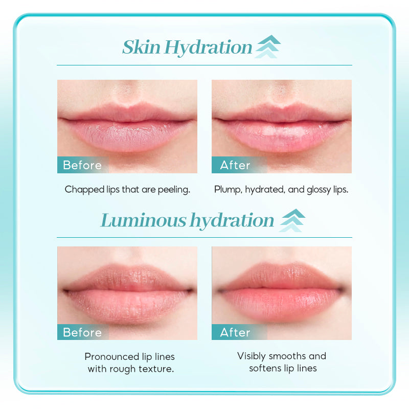 Lip Mask