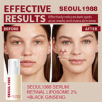 SEOUL 1988 SERUM Brightening