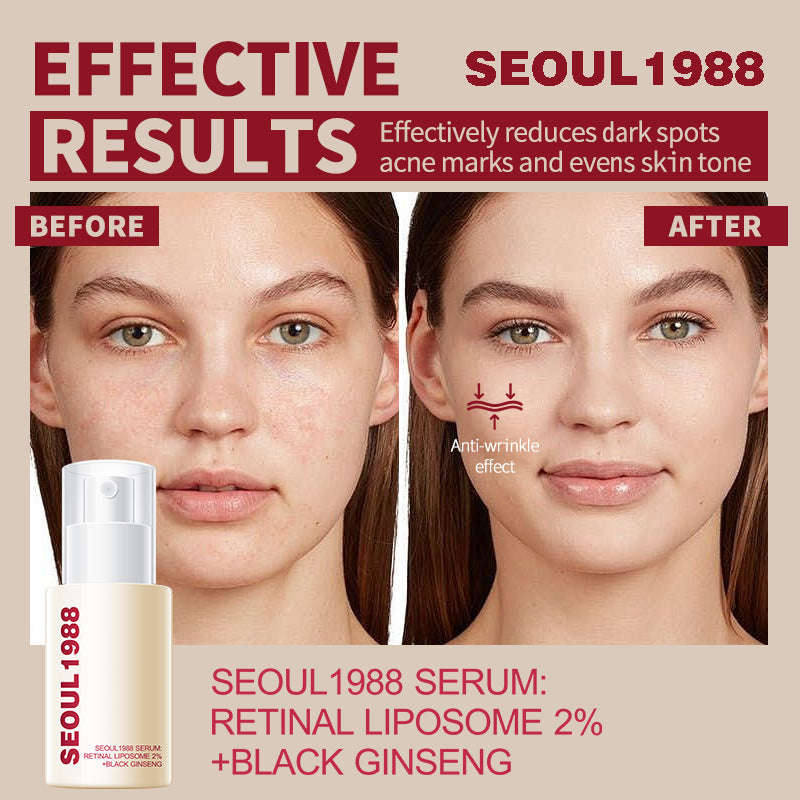 SEOUL 1988 SERUM Brightening