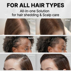 Grow:Turn Ampoule (for hair&scalp care)