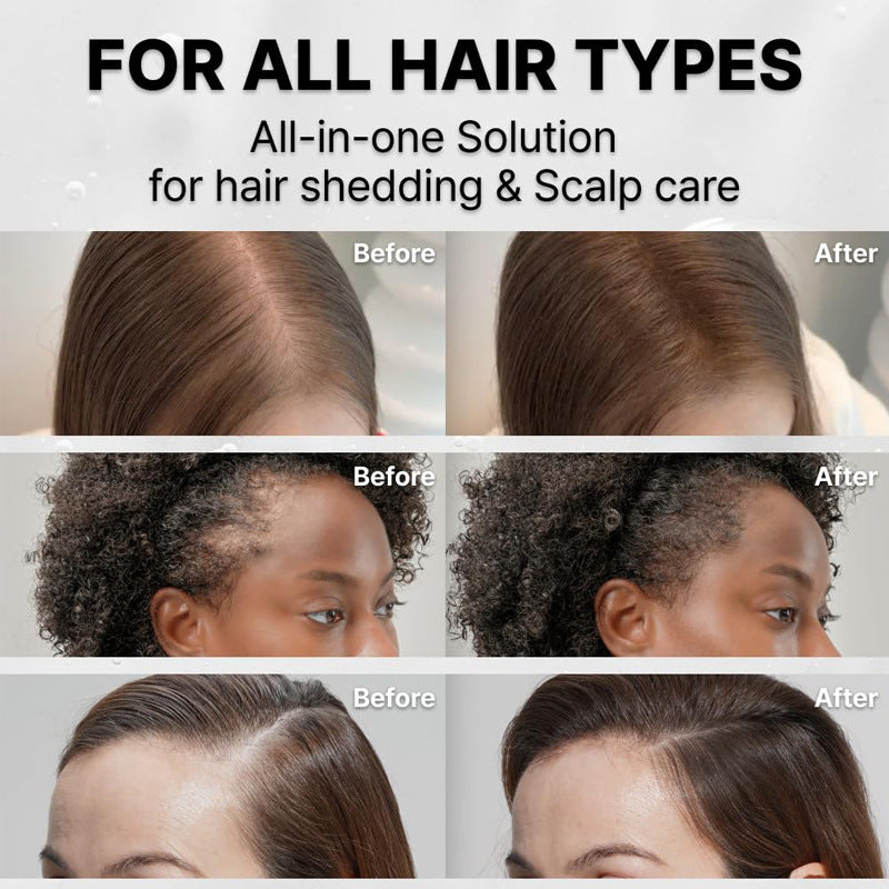 Grow:Turn Ampoule (for hair&scalp care)